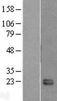 FKBP11 Human Over-expression Lysates NM_016594
