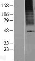 KCNK9 Human Over-expression Lysates NM_016601