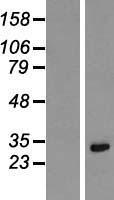 KRCC1 Human Over-expression Lysates NM_016618