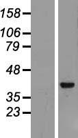 ls051321 archaemetzincin 2 amz2 human over expression lysates nm 001033569 wb testing 2