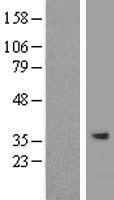 SPG21 Human Over-expression Lysates NM_001127889