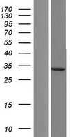 SPG21 Human Over-expression Lysates NM_001127890