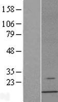AHSP Human Over-expression Lysates NM_016633