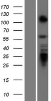 Pokemon (ZBTB7A) Human Over-expression Lysates NM_015898