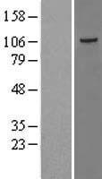 ls051347 taok3 human over expression lysates nm 016281 wb testing 1