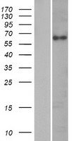 Cytokeratin 2 (KRT76) Human Over-expression Lysates NM_015848