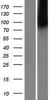 ls051360 s2p mbtps2 human over expression lysates nm 015884 wb testing 1