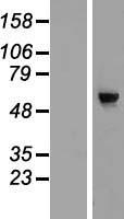 CDC40 Human Over-expression Lysates NM_015891