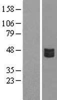 CRLF3 Human Over-expression Lysates NM_015986