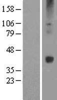 WNT16 Human Over-expression Lysates NM_016087