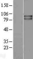 VRL1 (TRPV2) Human Over-expression Lysates NM_016113