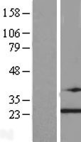 TRAPPC4 Human Over-expression Lysates NM_016146
