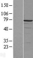 DDX41 Human Over-expression Lysates NM_016222