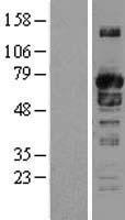 SH3PX1 (SNX9) Human Over-expression Lysates NM_016224