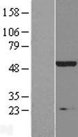 Inositol Hexakisphosphate Kinase 2 (IP6K2) Human Over-expression Lysates NM_001005909