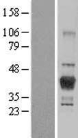 ls051451 lcmt1 human over expression lysates nm 016309 wb testing 1