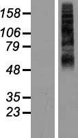 RHCG Human Over-expression Lysates NM_016321