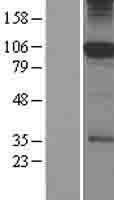 SFMBT1 Human Over-expression Lysates NM_001005159