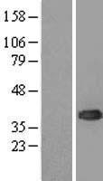 UBC6e (UBE2J1) Human Over-expression Lysates NM_016021