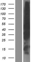 EVL Human Over-expression Lysates NM_016337