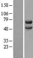 DCDC2 Human Over-expression Lysates NM_016356