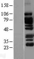EPLIN (LIMA1) Human Over-expression Lysates NM_016357