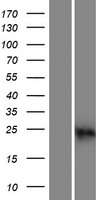 CABP2 Human Over-expression Lysates NM_016366