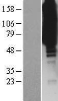 ISYNA1 Human Over-expression Lysates NM_016368