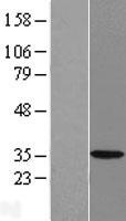 ls051478 hsd17b7 human over expression lysates nm 016371 wb testing 1