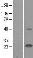 HSPC111 (NOP16) Human Over-expression Lysates NM_016391