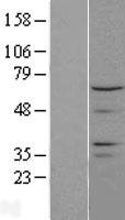 CTDSPL2 Human Over-expression Lysates NM_016396