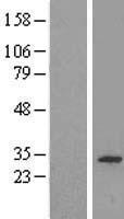 CWC15 Human Over-expression Lysates NM_016403