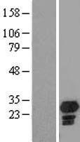 CHMP5 Human Over-expression Lysates NM_016410
