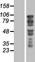 GTSE1 Human Over-expression Lysates NM_016426