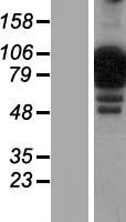 NCKIPSD Human Over-expression Lysates NM_184231