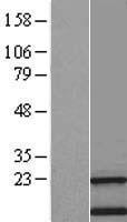TMEM138 Human Over-expression Lysates NM_016464