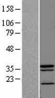ls051528 jkamp human over expression lysates nm 016475 wb testing 1