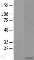 Apc11 (ANAPC11) Human Over-expression Lysates NM_001002245