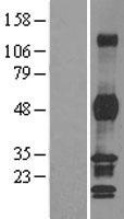 PHF7 Human Over-expression Lysates NM_016483