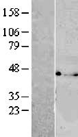 VTA1 Human Over-expression Lysates NM_016485