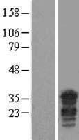 PPHLN1 Human Over-expression Lysates NM_201438