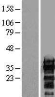 ZCCHC17 Human Over-expression Lysates NM_016505