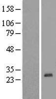 ZNF581 Human Over-expression Lysates NM_016535