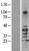 SIRT7 Human Over-expression Lysates NM_016538
