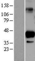 ls051548 sirt6 human over expression lysates nm 016539 wb testing 1