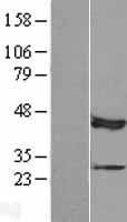 MAP3K12 binding inhibitory protein 1 (MBIP) Human Over-expression Lysates NM_016586