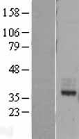 MIR16 (GDE1) Human Over-expression Lysates NM_016641