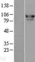 MED15 Human Over-expression Lysates NM_015889