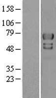 E3 SUMO protein ligase PIAS4 (PIAS4) Human Over-expression Lysates NM_015897