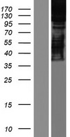 ARS2 (SRRT) Human Over-expression Lysates NM_015908